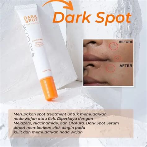 dark spot serum ms glow